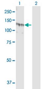SSH1 Polyclonal Antibody, MaxPab™