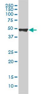 KRT20 Antibody in Western Blot (WB)
