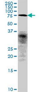 CCDC93 Antibody in Western Blot (WB)