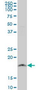 NDUFB11 Monoclonal Antibody (4B2)