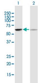 UGT1A6 Antibody in Western Blot (WB)