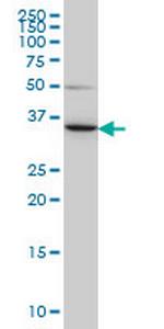 LZTFL1 Monoclonal Antibody (7F6)