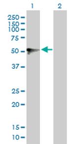UGT1A9 Antibody in Western Blot (WB)
