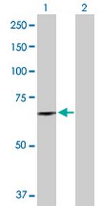DDX56 Polyclonal Antibody, MaxPab™
