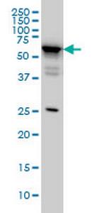 DDX56 Monoclonal Antibody (4C5)