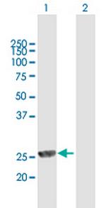 MPHOSPH8 Polyclonal Antibody, MaxPab™
