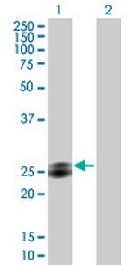 EPDR1 Antibody in Western Blot (WB)