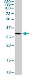 EPDR1 Antibody in Western Blot (WB)
