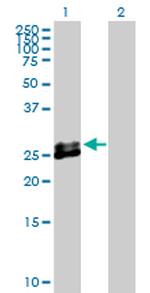 EPDR1 Polyclonal Antibody, MaxPab™