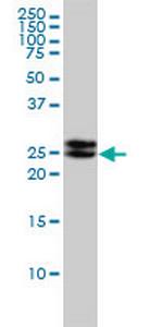 EPDR1 Monoclonal Antibody (1C1)