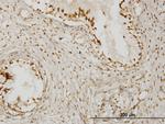 KLHDC4 Antibody in Immunohistochemistry (Paraffin) (IHC (P))