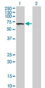 KLHDC4 Antibody in Western Blot (WB)