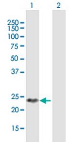 DIRAS2 Polyclonal Antibody, MaxPab™