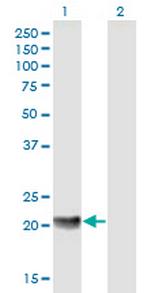 MED18 Antibody in Western Blot (WB)