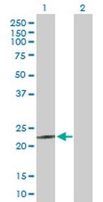 MED18 Antibody in Western Blot (WB)