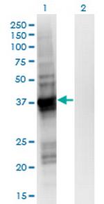 GIPC2 Monoclonal Antibody (4H8)