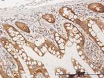 CC2D1A Antibody in Immunohistochemistry (Paraffin) (IHC (P))