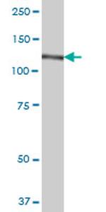 CC2D1A Antibody in Western Blot (WB)