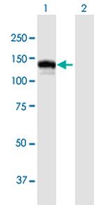 CC2D1A Antibody in Western Blot (WB)