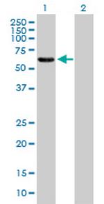 EPS8L1 Polyclonal Antibody, MaxPab™