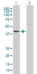 ZCCHC2 Polyclonal Antibody, MaxPab™