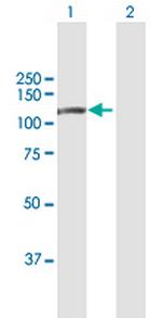 DPP8 Polyclonal Antibody, MaxPab™