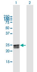 FLJ20397 Polyclonal Antibody, MaxPab™