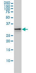 UBE2R2 Monoclonal Antibody (5E7)
