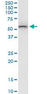 SARS2 Polyclonal Antibody, MaxPab™