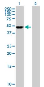 UCKL1 Polyclonal Antibody, MaxPab™