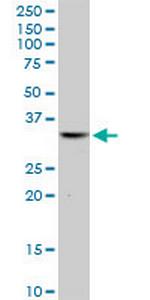 ICF45 Polyclonal Antibody, MaxPab™
