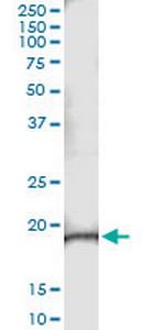 C9orf95 Monoclonal Antibody (2A10)