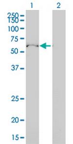 ULK4 Monoclonal Antibody (4A10-1A7)