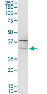 PIH1D1 Polyclonal Antibody, MaxPab™