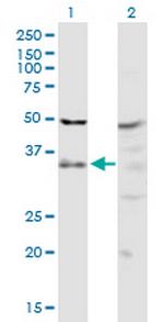 PIH1D1 Polyclonal Antibody, MaxPab™