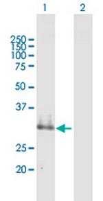 SUSD4 Polyclonal Antibody, MaxPab™