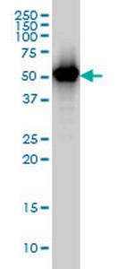 TAPBPL Antibody in Western Blot (WB)