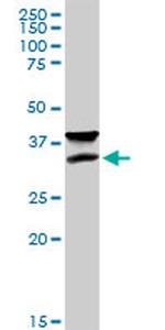 IFT57 Antibody in Western Blot (WB)