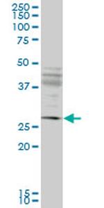 IFT57 Antibody in Western Blot (WB)