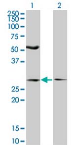 IFT57 Monoclonal Antibody (3G4)