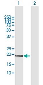 MED9 Antibody in Western Blot (WB)