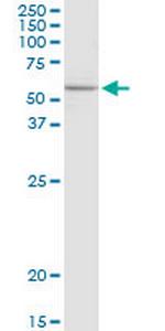 ELP3 Polyclonal Antibody, MaxPab™