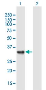 CDCA8 Antibody in Western Blot (WB)