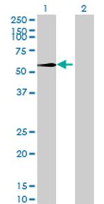 RNMTL1 Antibody in Western Blot (WB)