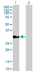 RPRD1A Antibody in Western Blot (WB)
