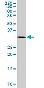 RPRD1A Monoclonal Antibody (1B9)