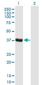 DPPA4 Antibody in Western Blot (WB)