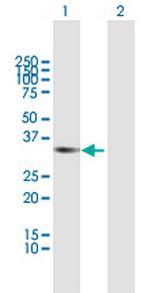 RCBTB1 Polyclonal Antibody, MaxPab™