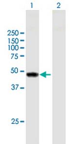 TYW1 Antibody in Western Blot (WB)