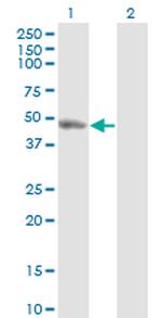 TYW1 Antibody in Western Blot (WB)